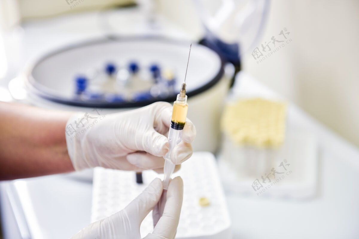细胞富血小板血浆注射器准备手里拿着等离子样品科学化学