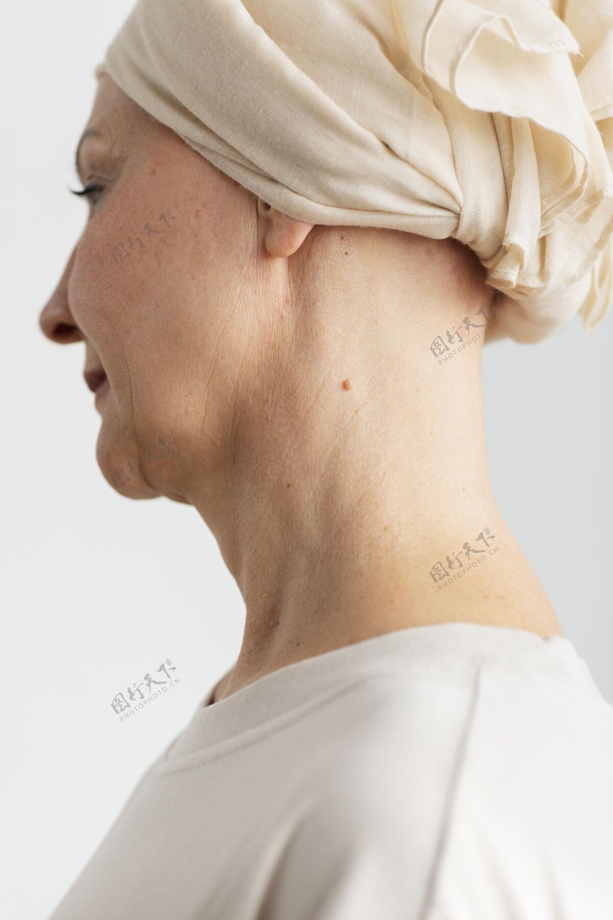 女性皮肤癌中年妇女画像肖像保健秃头