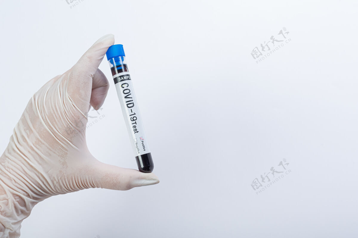 流行病带血样的试管用于covid-19测试临床预防分析
