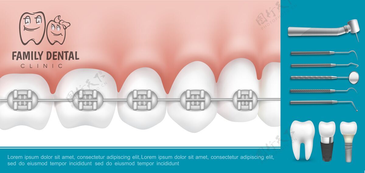 植入物真实的牙科和口腔医学组成与金属支架上的牙齿口腔医疗器械和牙科植入物牙科仪器金属