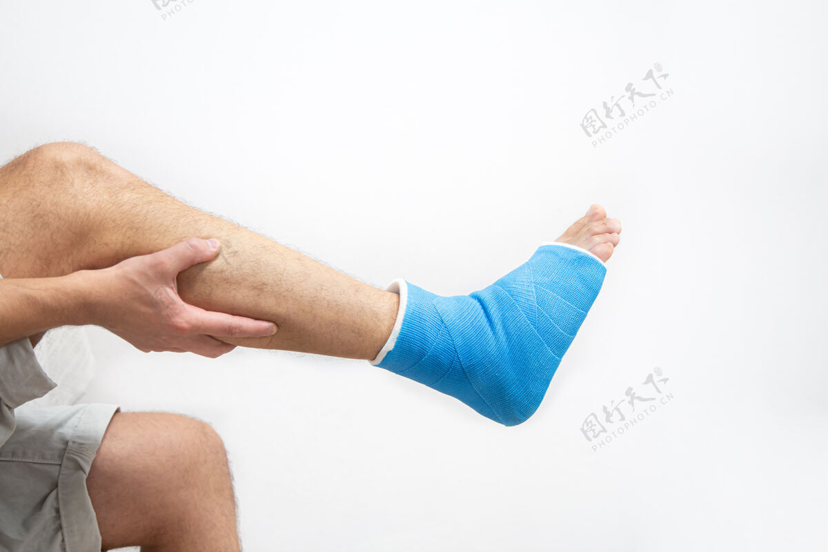 绷带蓝色夹板脚踝绷带腿上的男性患者白色背景上铸造孤立运动损伤的概念脚骨折扭伤