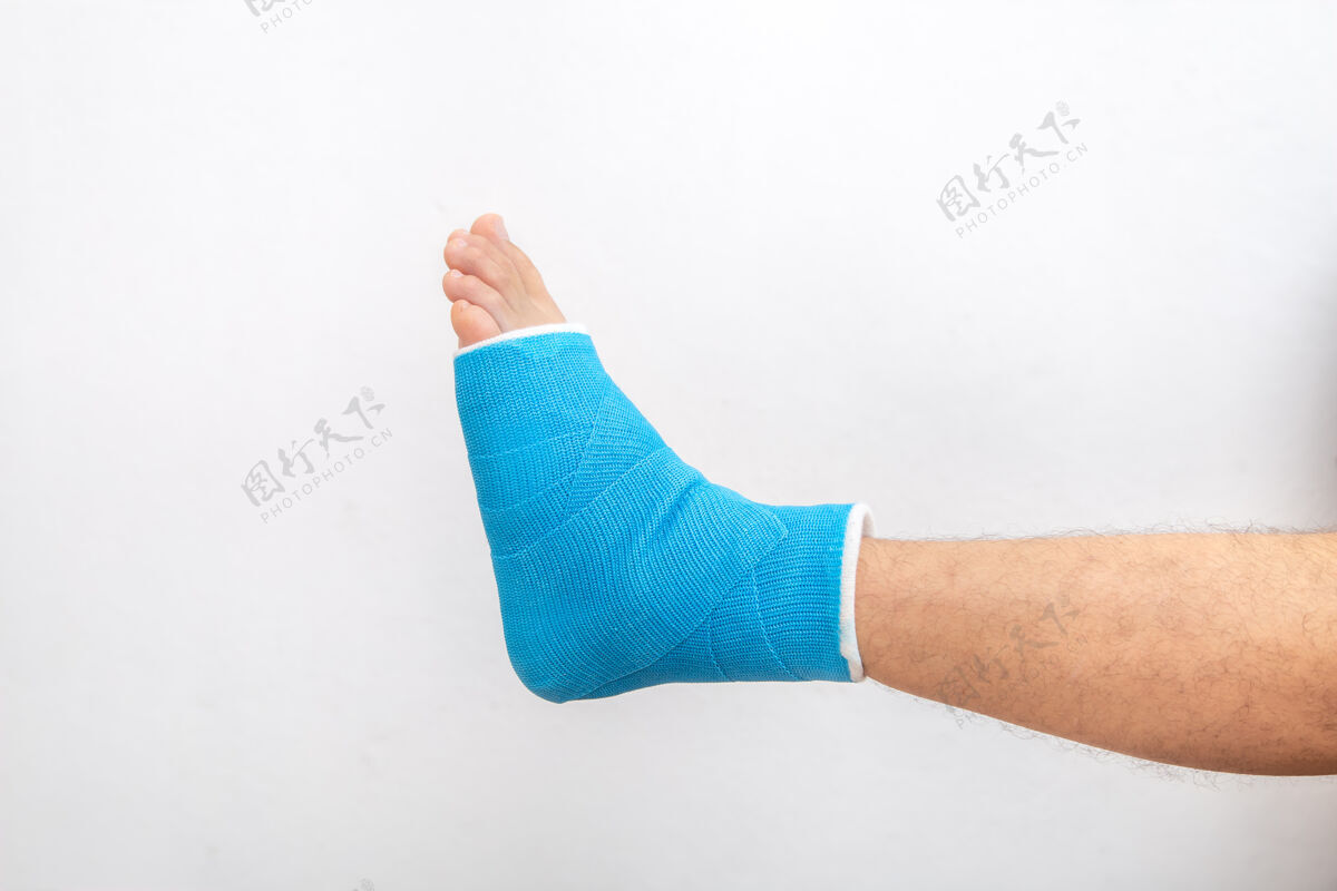 受伤蓝色夹板脚踝绷带腿上的男性患者白色背景上铸造孤立运动损伤的概念下脚踝骨折